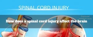 spinal cord injury post