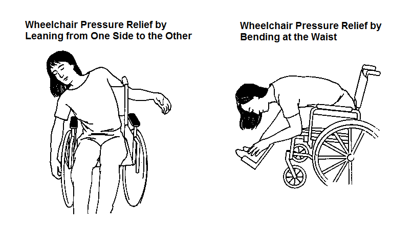wheelchair pressure positioning
